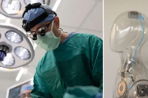A Neurosurgeon Just Implanted a New Brain Chip in a Patient, And It Could Change How Humans Communicate