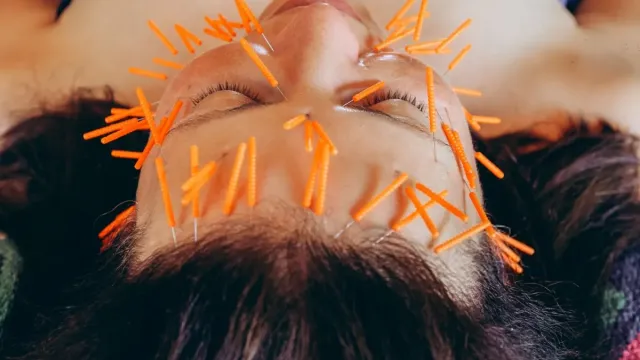 The Natural Botox? How Facial Acupuncture is Rewiring the Anti-Aging Scene