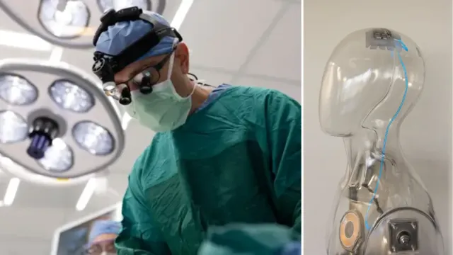 A Neurosurgeon Just Implanted a New Brain Chip in a Patient, And It Could Change How Humans Communicate